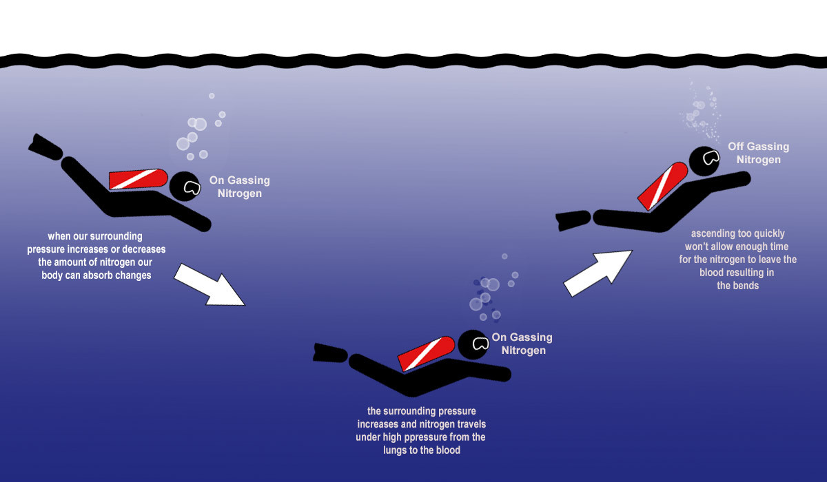 Decompression Sickness