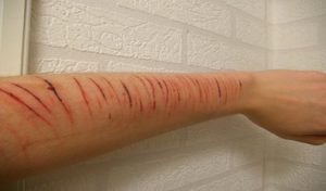 bites-cuts-main